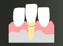Imagen Frontal