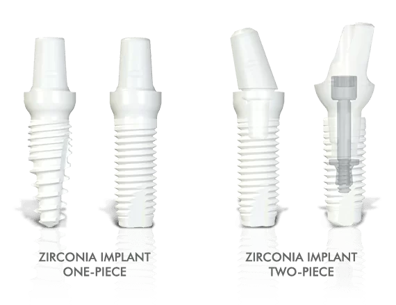 visual difference between a one-piece zirconia implant and two-pieces zirconia implant